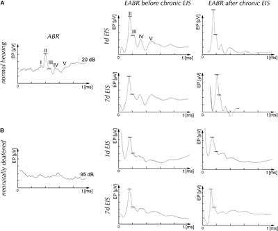 Astrocyte Hypertrophy and Microglia Activation in the Rat Auditory Midbrain Is Induced by Electrical Intracochlear Stimulation